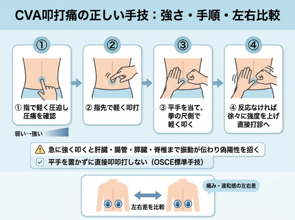 CVA叩打痛の正しい手技